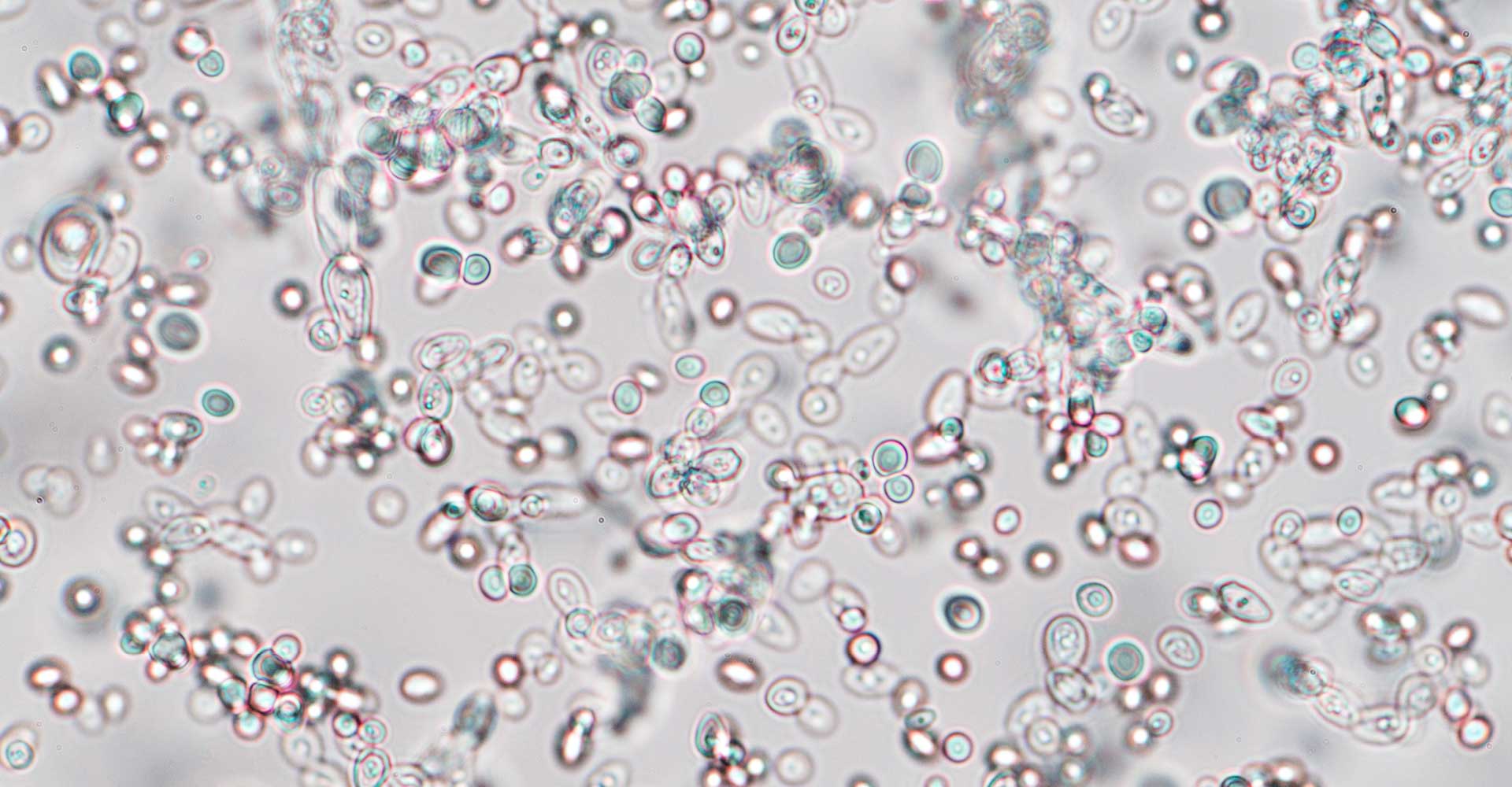 Under the Microscope: Dealing with Diastaticus in the Brewhouse